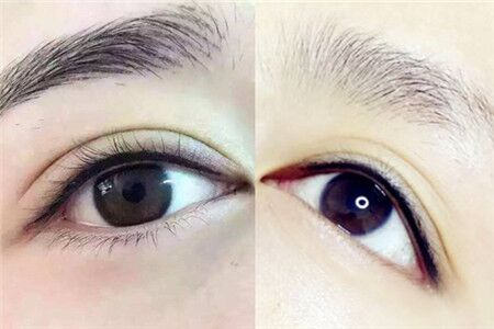 【图】美睫线和美瞳线的区别适用于什么人群(图1)